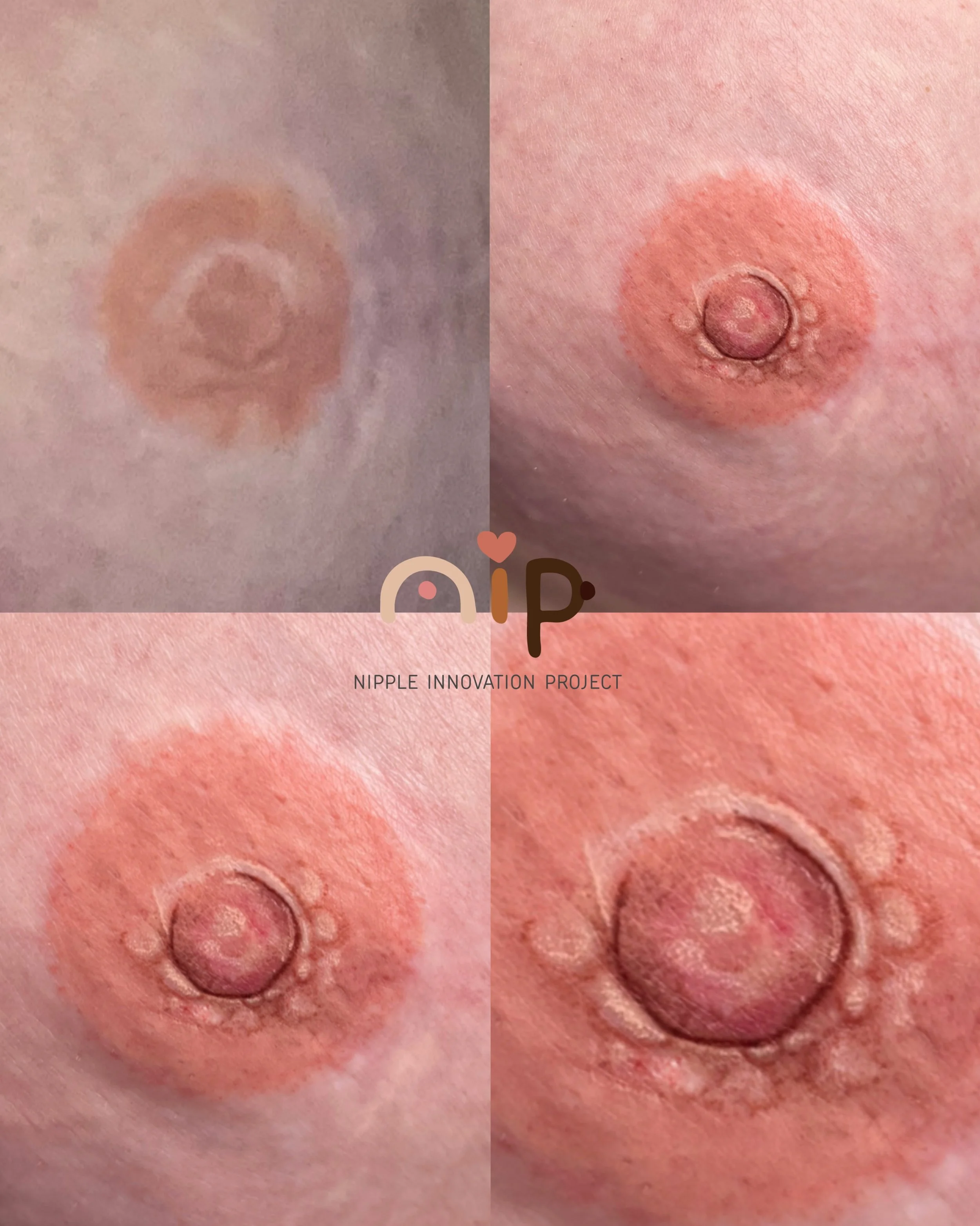 THE NORTHWEST CANCER CARE CONFRENCE 2025 - 6.jpeg