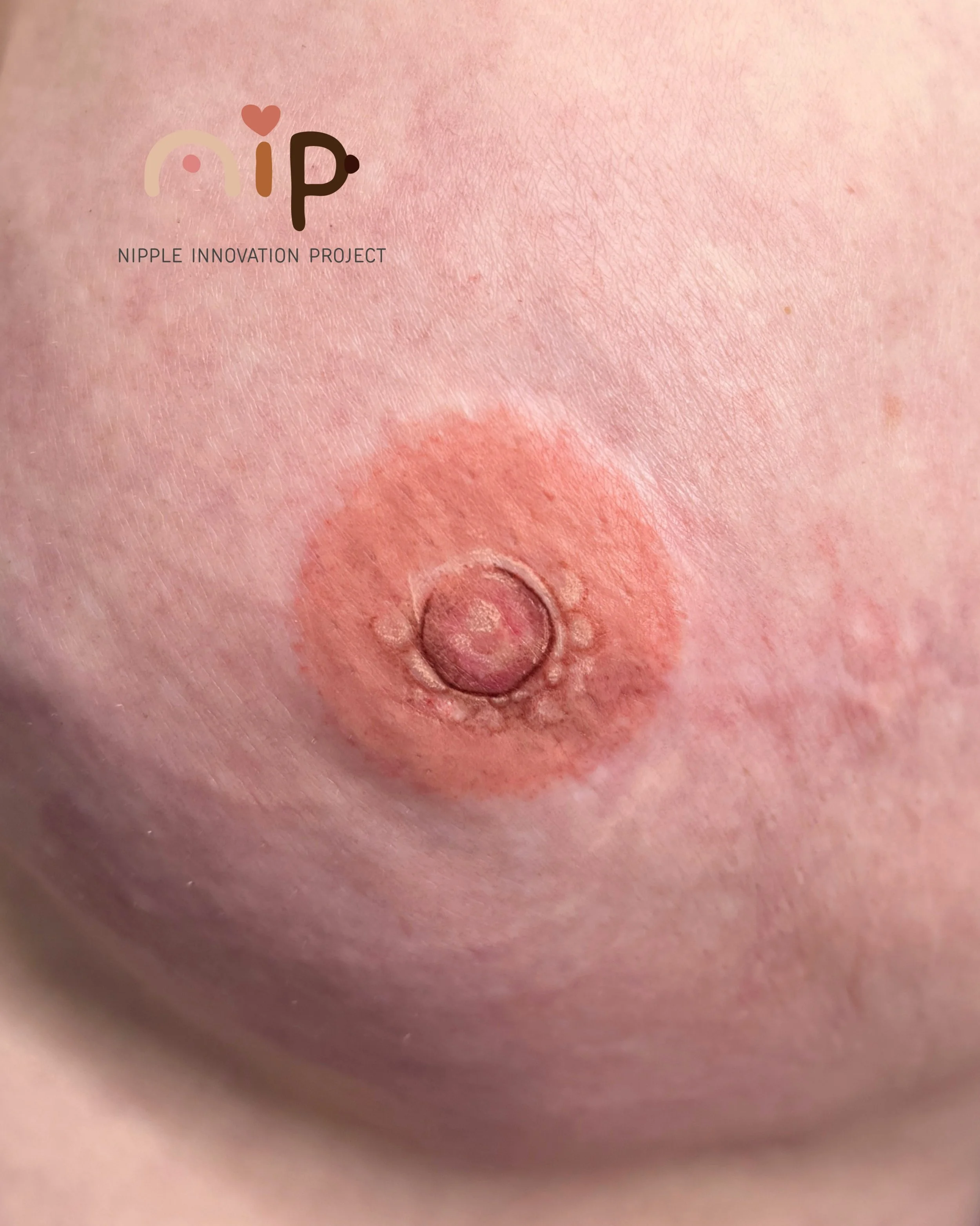 THE NORTHWEST CANCER CARE CONFRENCE 2025 - 5.jpeg