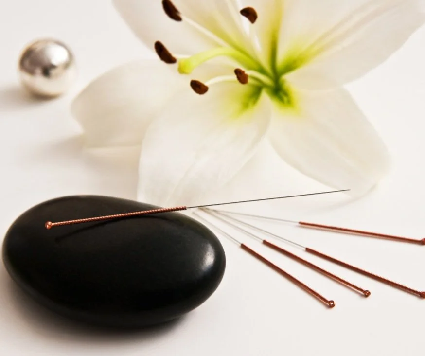 Acupuncture A Natural Way to Alleviate Symptoms and Improve Recovery