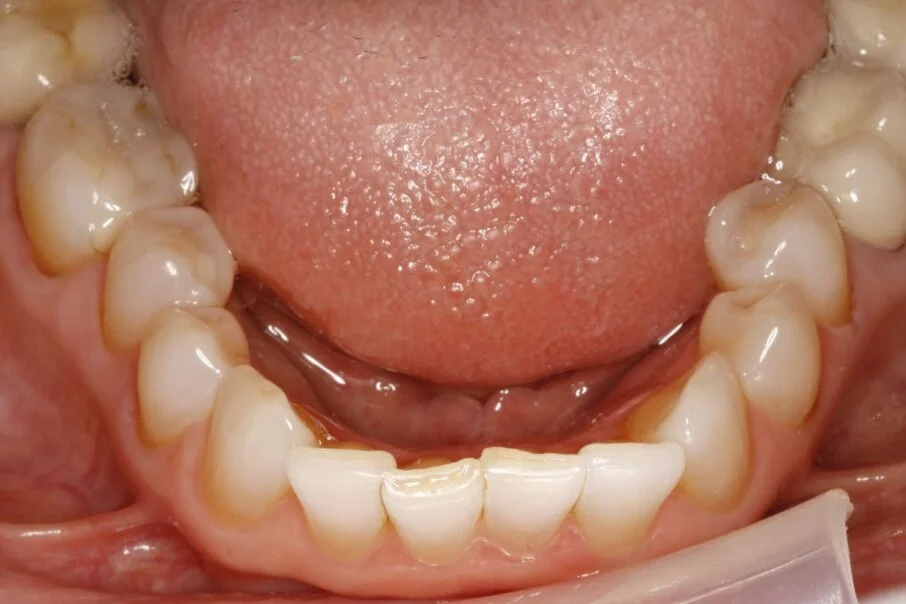 Smile Gallery — Nu Smile Roseville California. Our team can do more than transform your smile