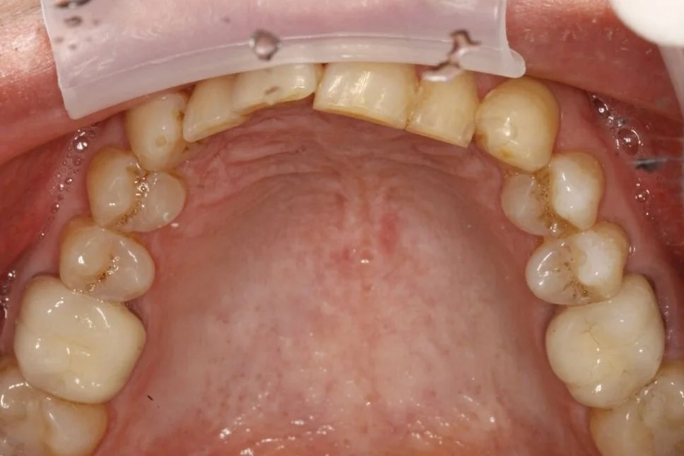 Smile Gallery — Nu Smile Roseville California. Our team can do more than transform your smile