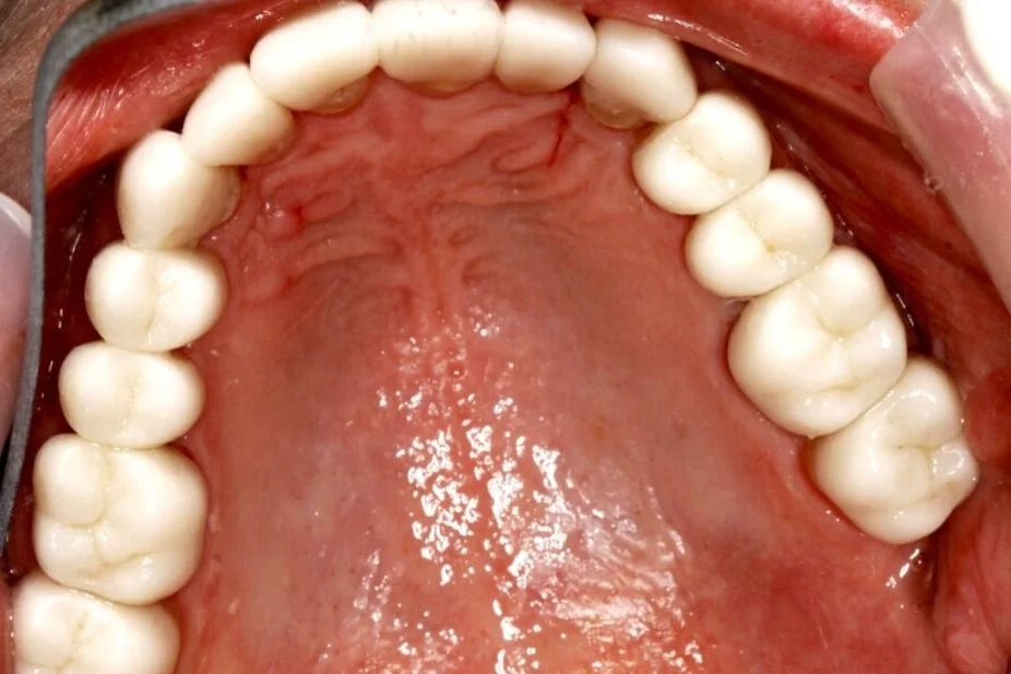 Smile Gallery — Nu Smile Roseville California. Our team can do more than transform your smile