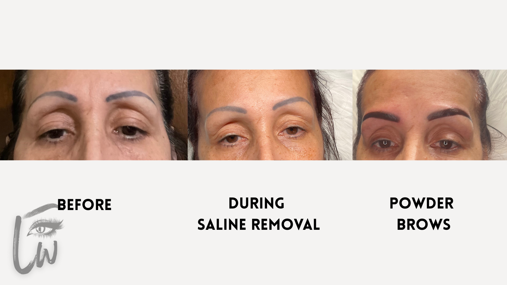 Microblading Gone Wrong: Can It Be Fixed?