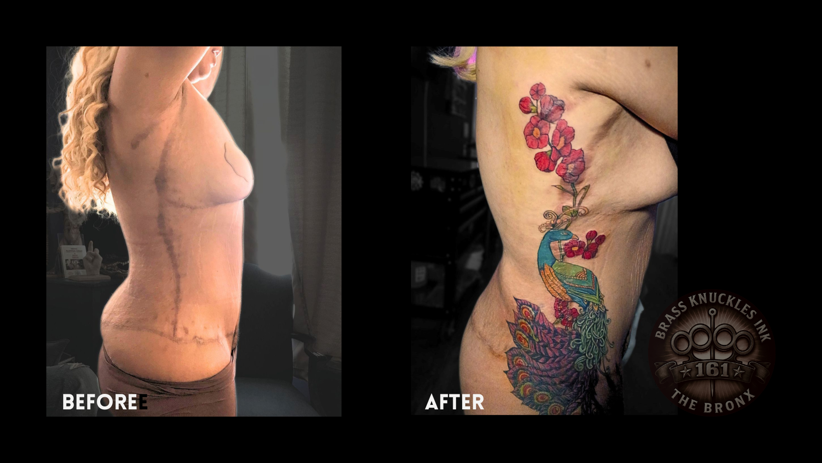 Scar Cover-Up Tattoos: How Ink Can Redefine Your Skin