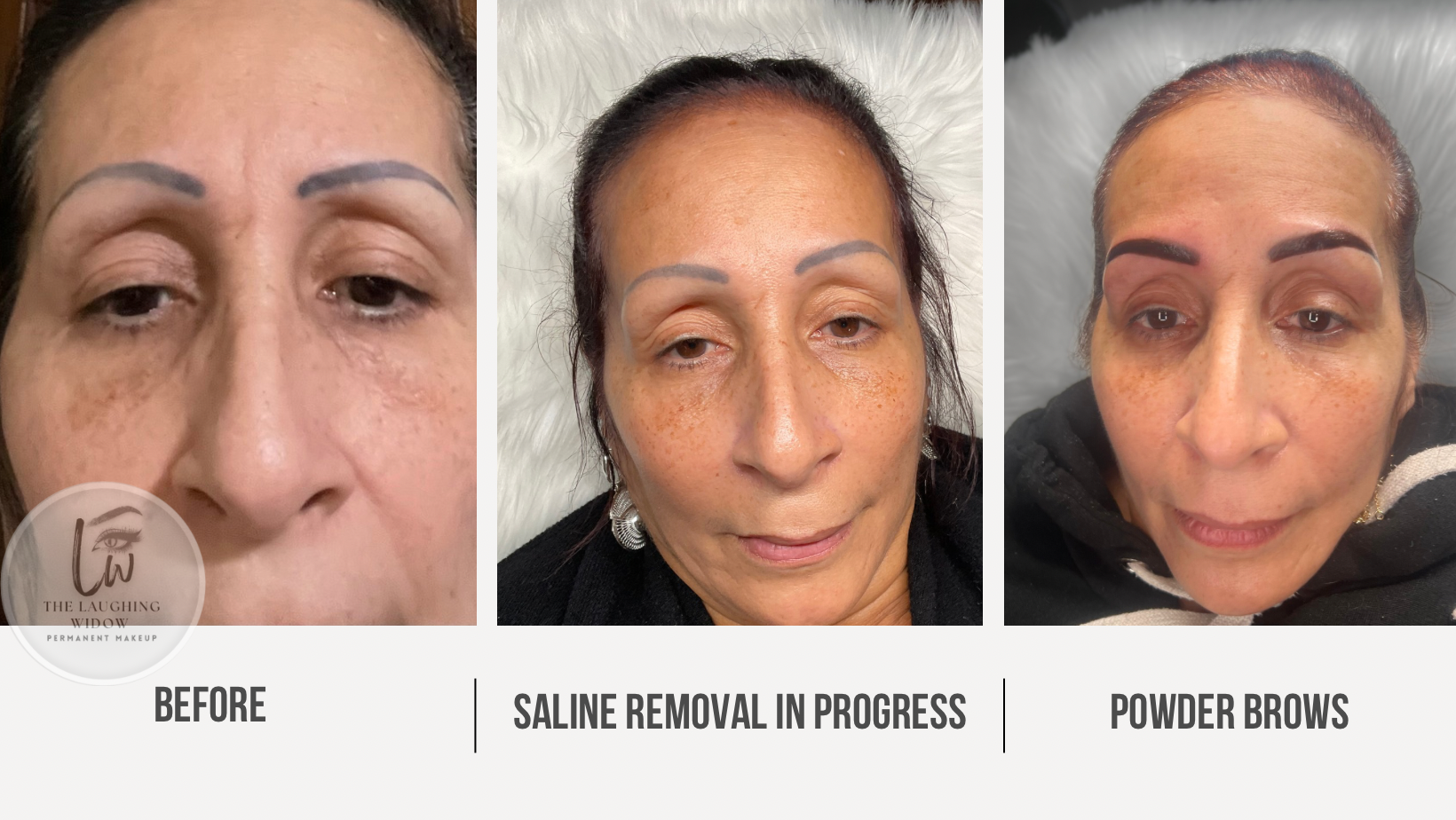 Before and after corrective permanent makeup showing old brow tattoo, saline removal in progress and freshly completed powder brows for a natural brow restoration.