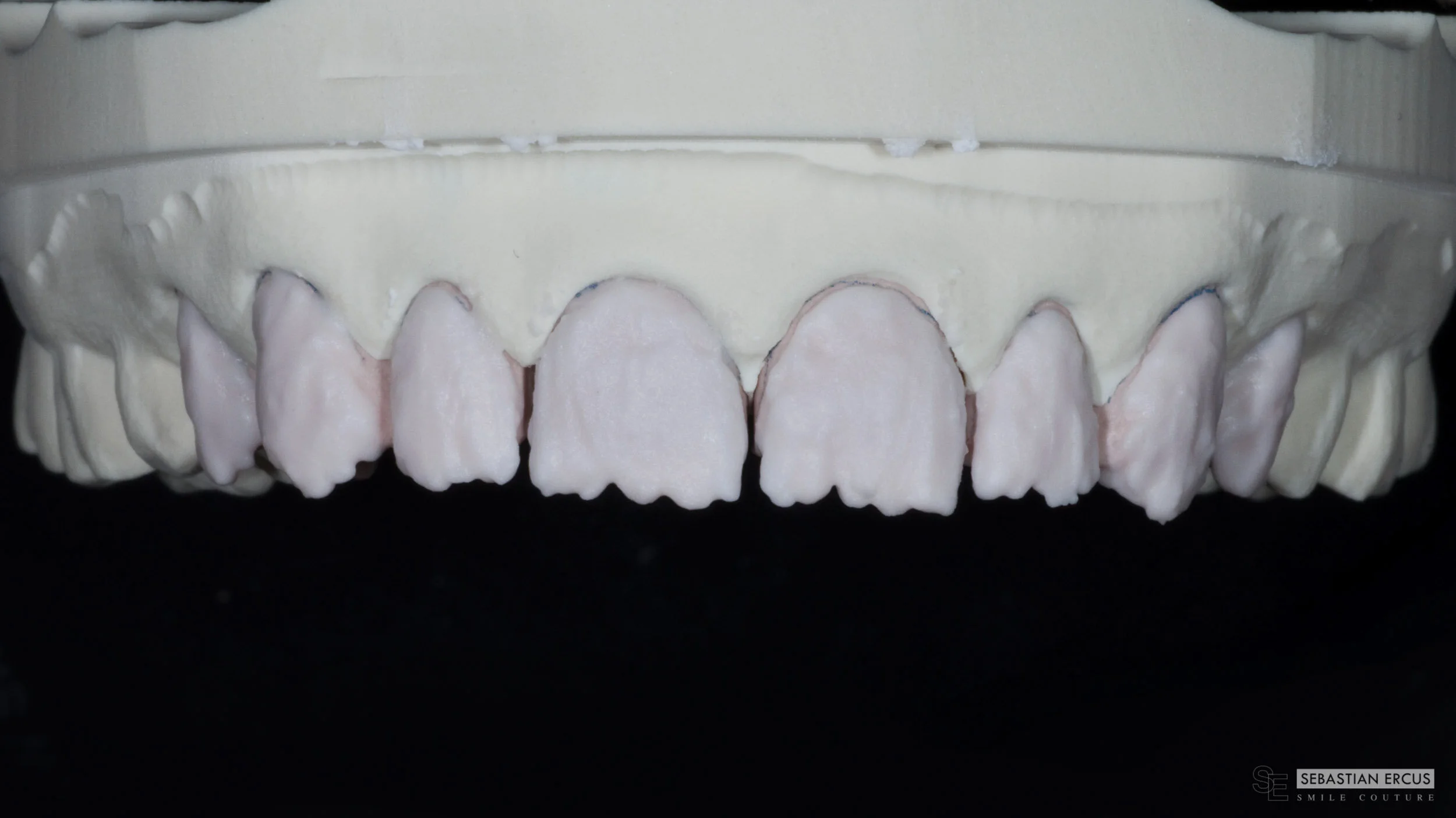 Stratification de porcelaine feldspathique.