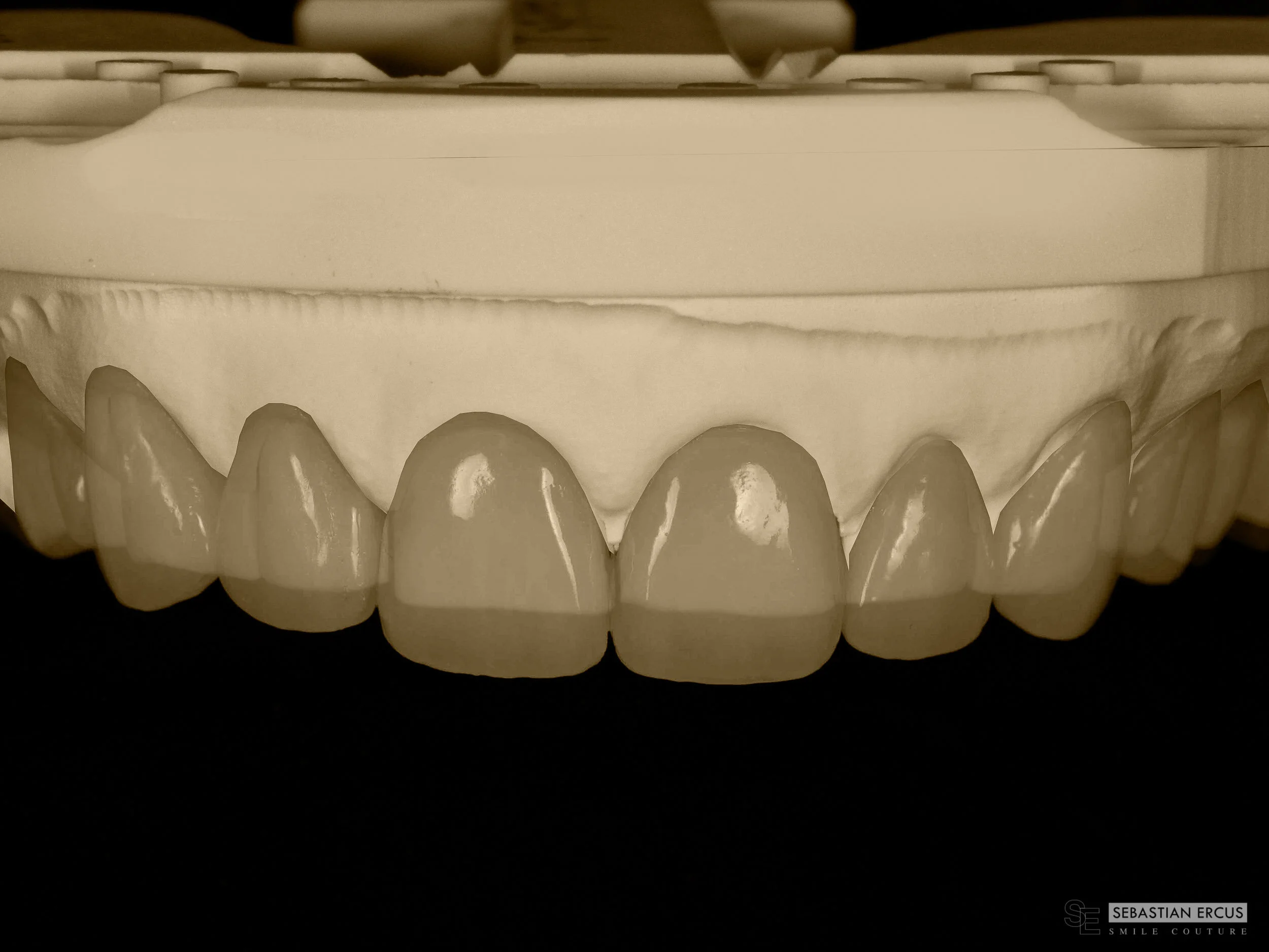 Modèle imprimé i tero.
