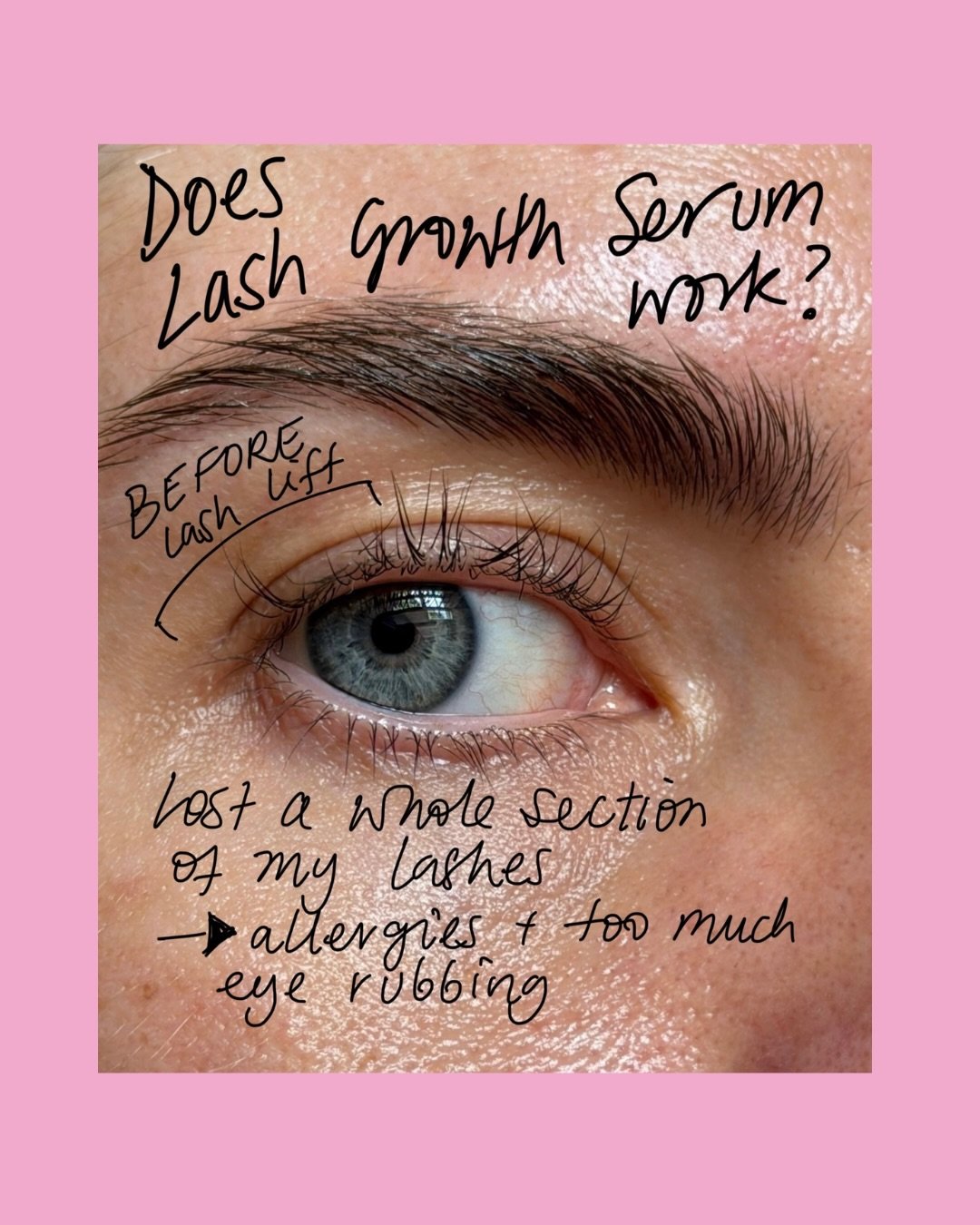 This before &amp; after tells a story I didn&rsquo;t plan, but couldn&rsquo;t have staged better 👏🏼

See that patchy section in the before pic? Had a bout of allergies and was rubbing my eyes constantly, lost a whole section of lashes in one spot. 