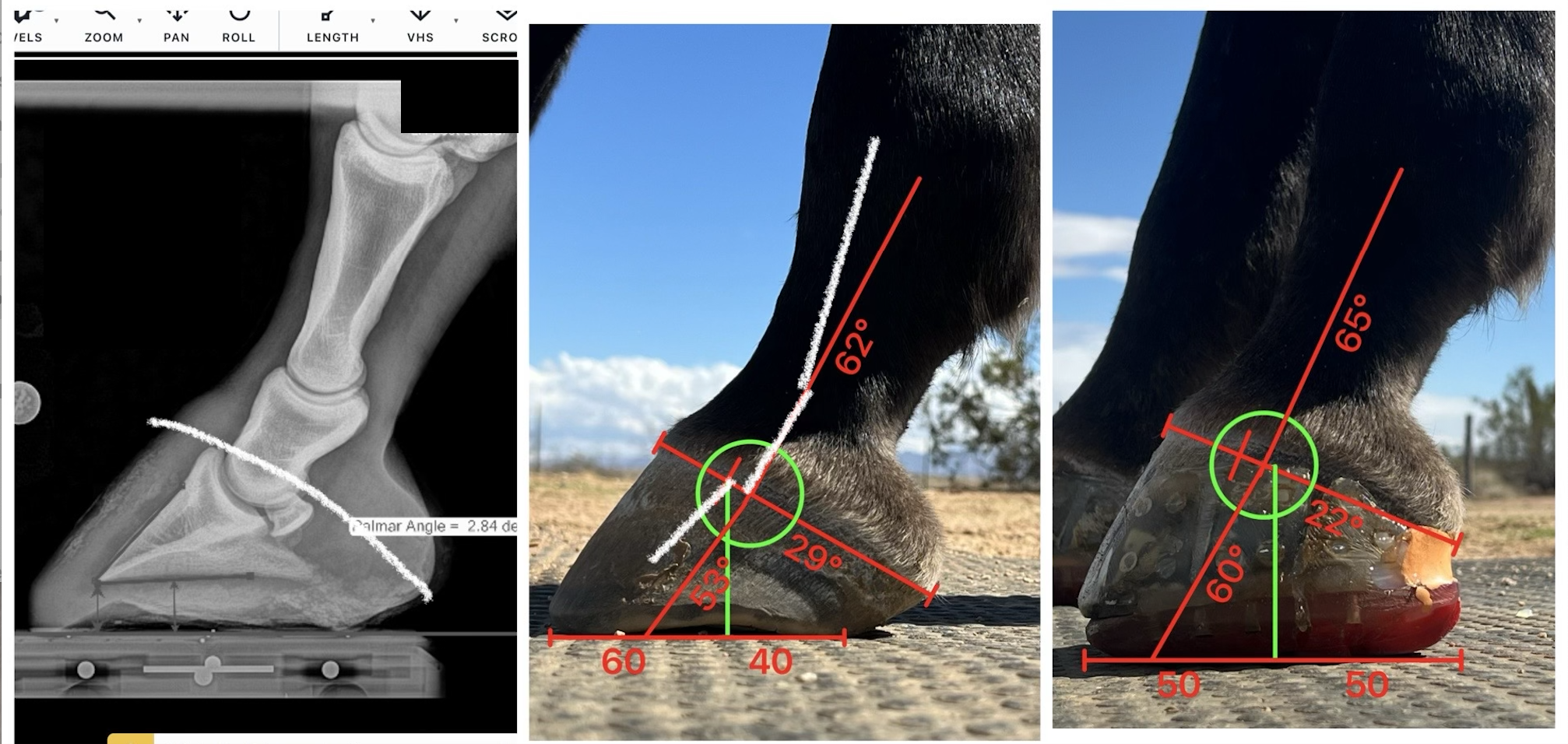 Corrective shoeing for chronically low-angled hind hooves to improve posture, comfort, and function of the limb and hind quarters.