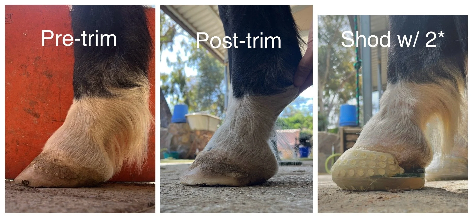 The stages of adding a therapeutic composite shoe.