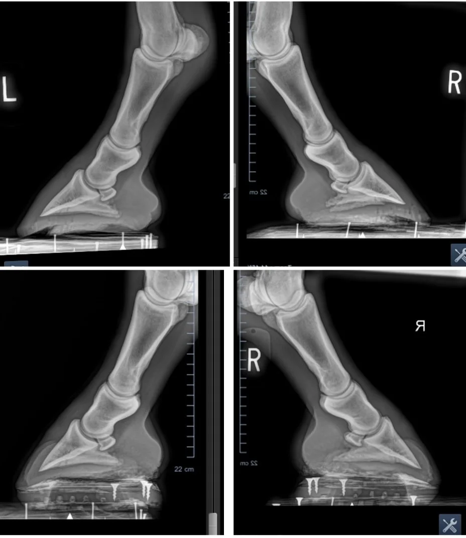 The upper row x-rays were taken right before this mare came to me the first time. Bottom row is at the end of her second cycle in wedges to improve her diagnosed negative plantar angles. Results were improved plantar angles upwards of 5 degrees along