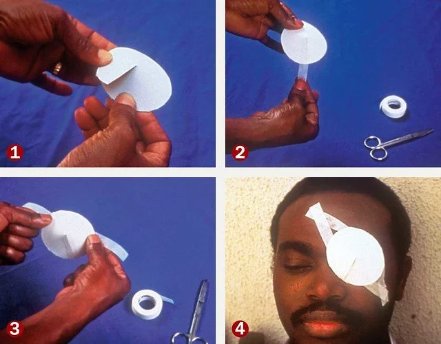 eyepatch_step-by-step.jpg