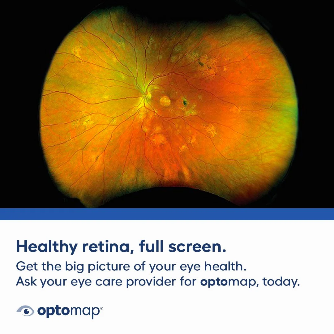 Full-screen view of a healthy human retina showing blood vessels and the optic nerve.