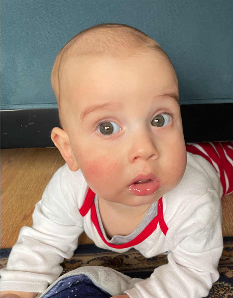 Henrik Anderson | 3/25/2024 - 7/11/2025