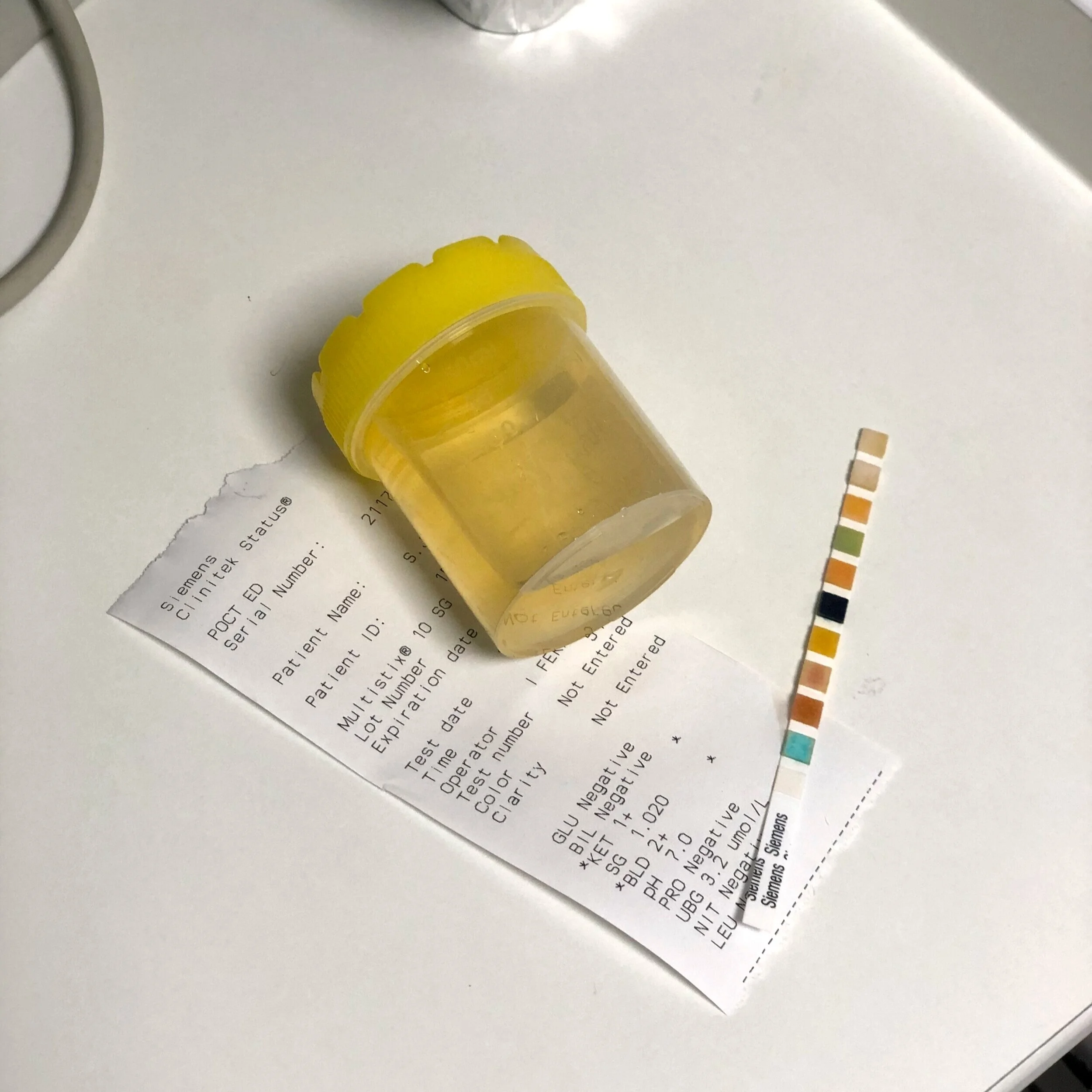 Septic Shock Level A — St. James' Hospital Emergency Department