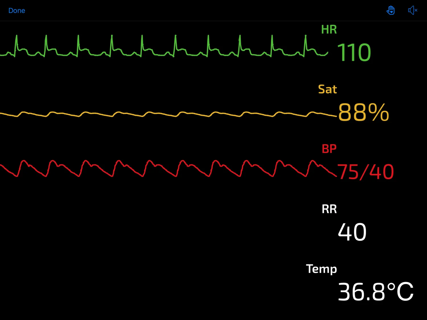 Cardiogenic Shock Level A — St. James' Hospital Emergency Department