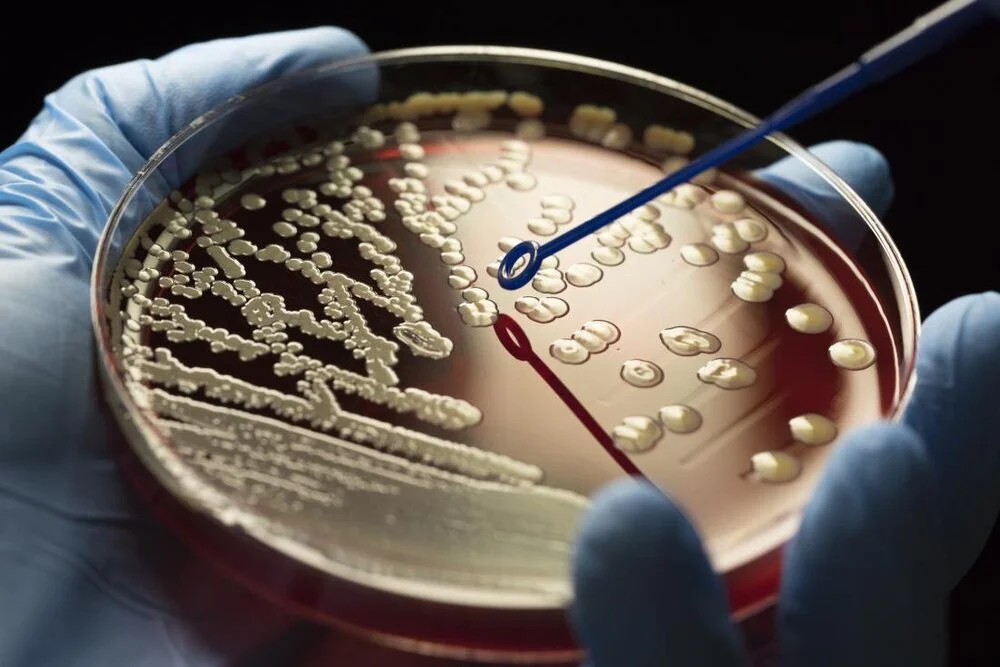 mrsa-in-petri-dish.jpg