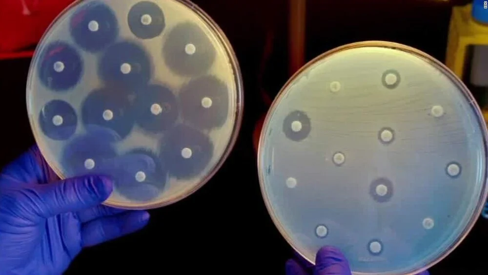 Example of antibiotic resistance. The way we test for resistance is by streaking a lawn of a single strain of bacteria on an agar plate and place these antibiotic disks throughout the plate. Each disk is a single type of antibiotics, and it is diffu…