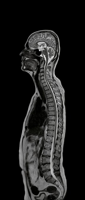 P16_0110h_Whole_CNS_T2.jpg