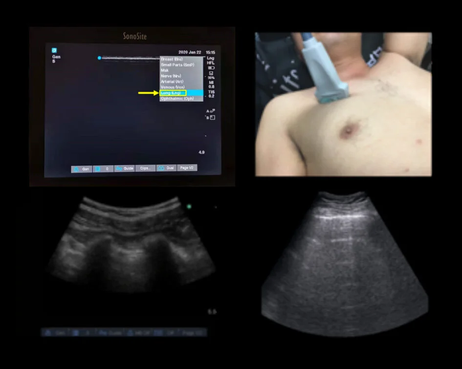 Fujifilm Sonosite providing educational support on managing COVID-19 using Point-of-Care Ultrasound