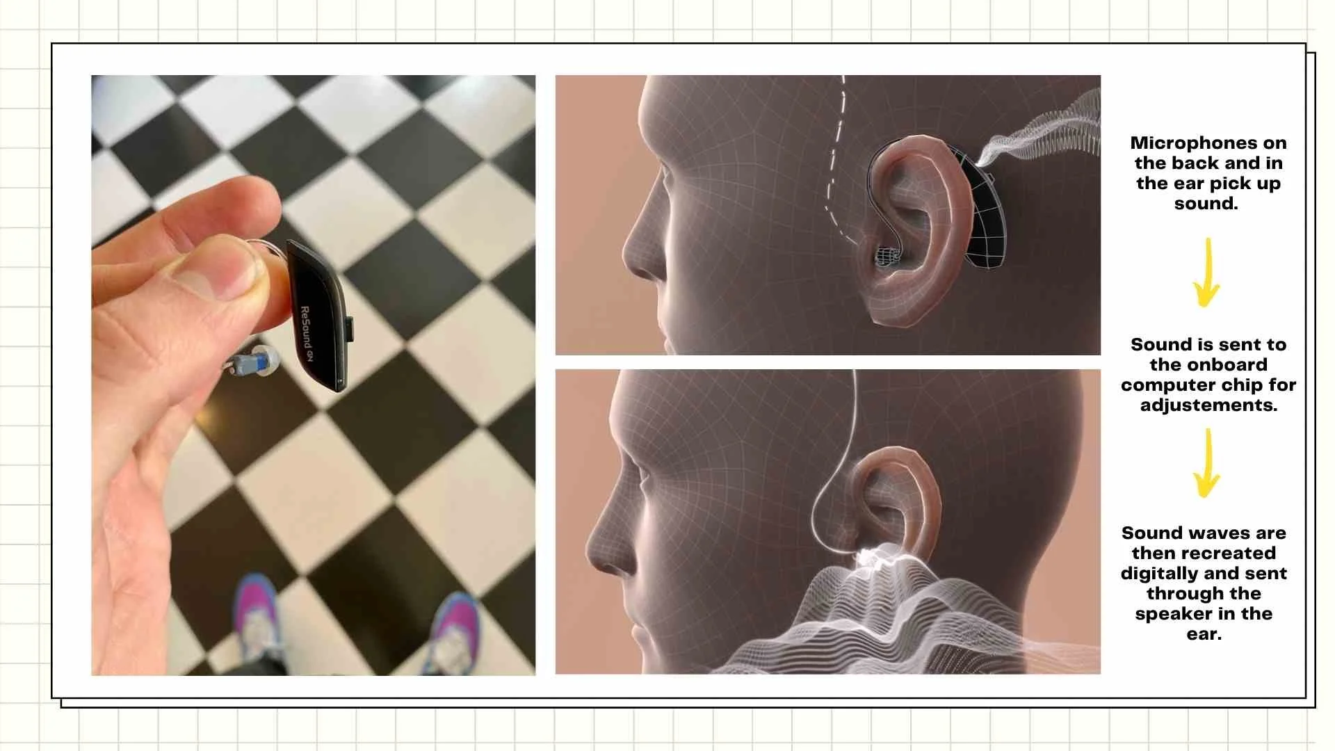 Hearing Aids Explained Prices, Process, Styles and More — Hear Soundly
