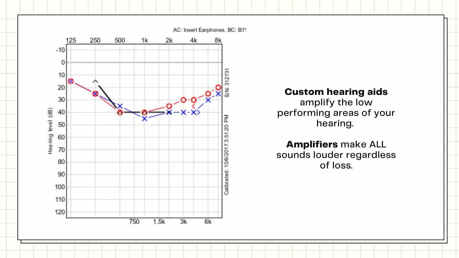 Hearing Aids Explained Prices, Process, Styles and More — Hear Soundly