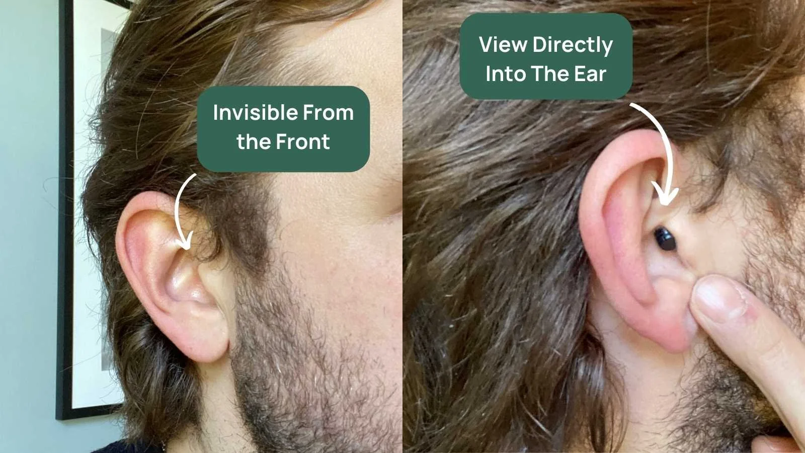 Eargo 7 Review, Prices, Unboxing and Surprises — Soundly
