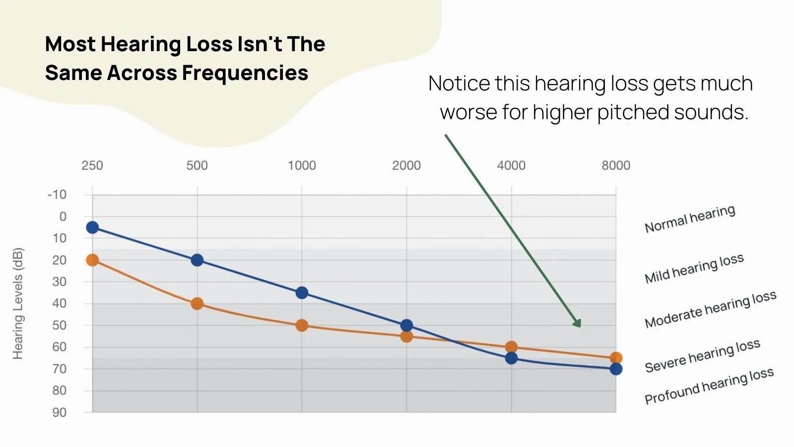 How much do hearing aids cost? Up to date price list. — Soundly