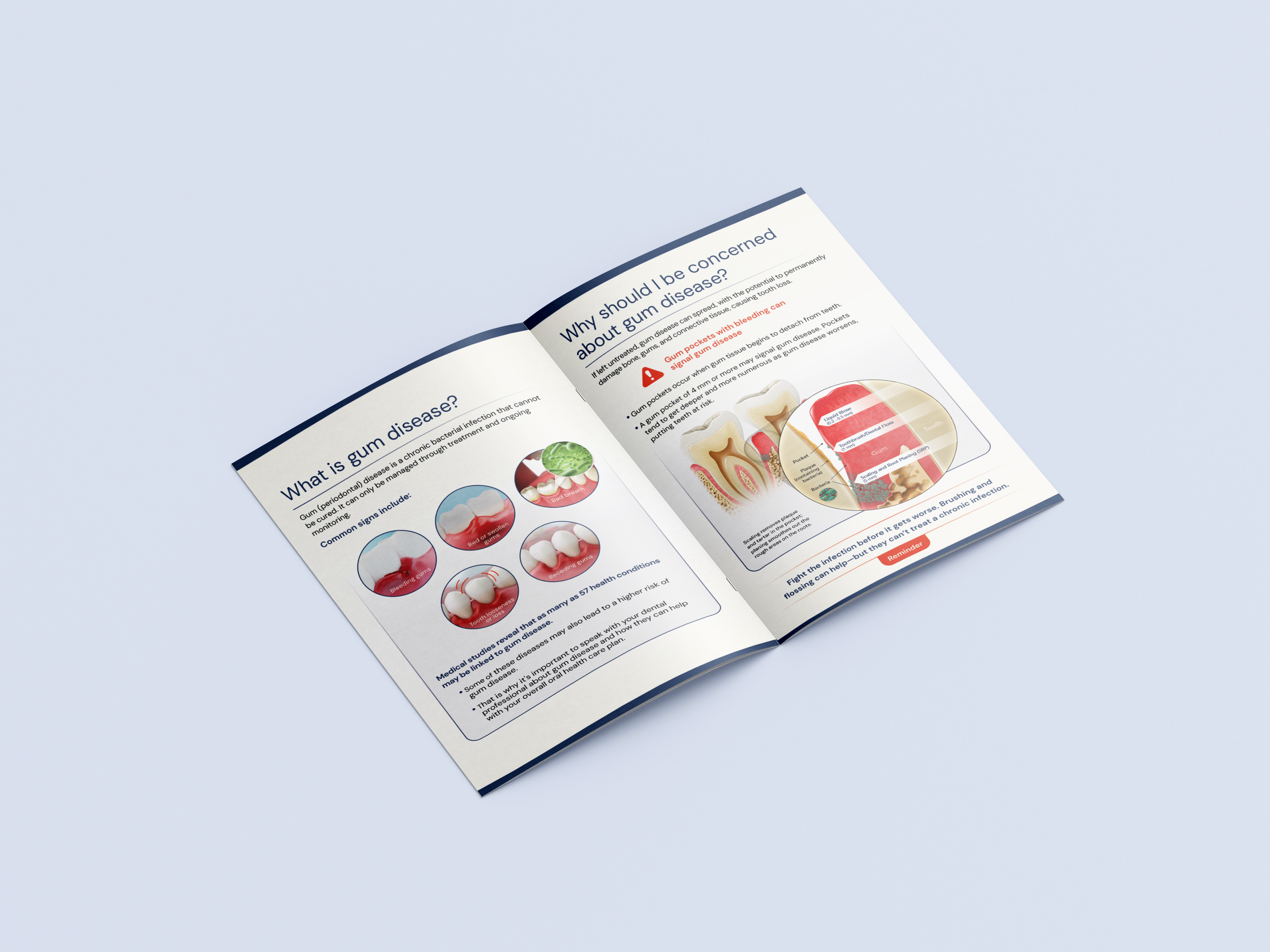 Patient Brochure 