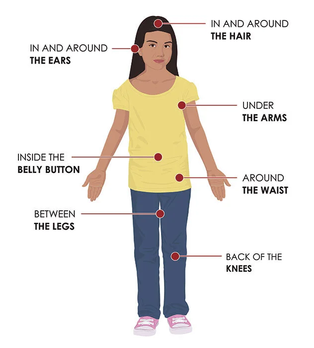 Lyme Disease Means Taking Ticks Seriously