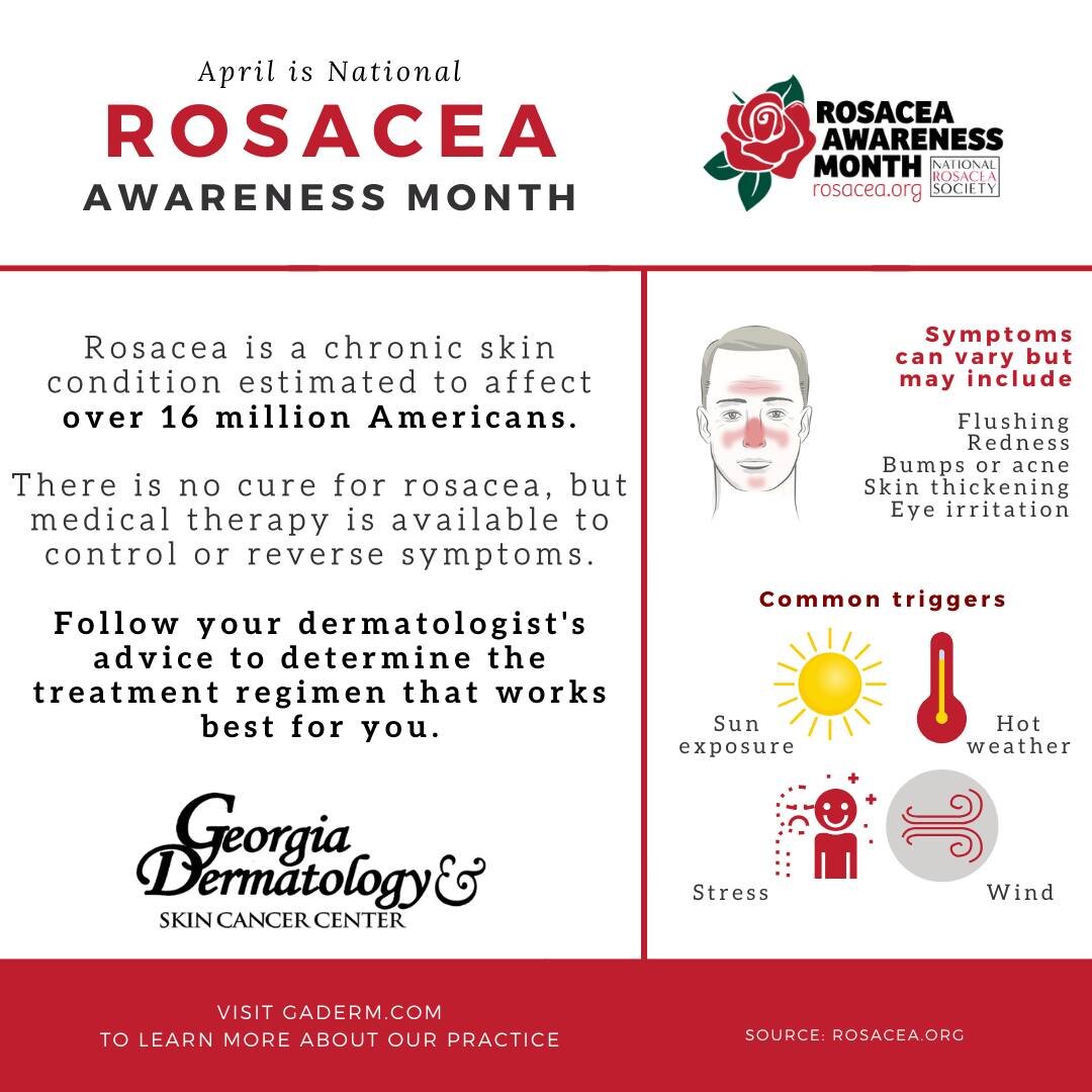 April is National Rosacea Awareness month! 🌹⁣
⁣
Rosacea is a chronic but treatable condition that primarily affects the central face and is often characterized by flare-ups and remissions. ⁣
⁣
An estimated 16 million Americans have rosacea, yet only