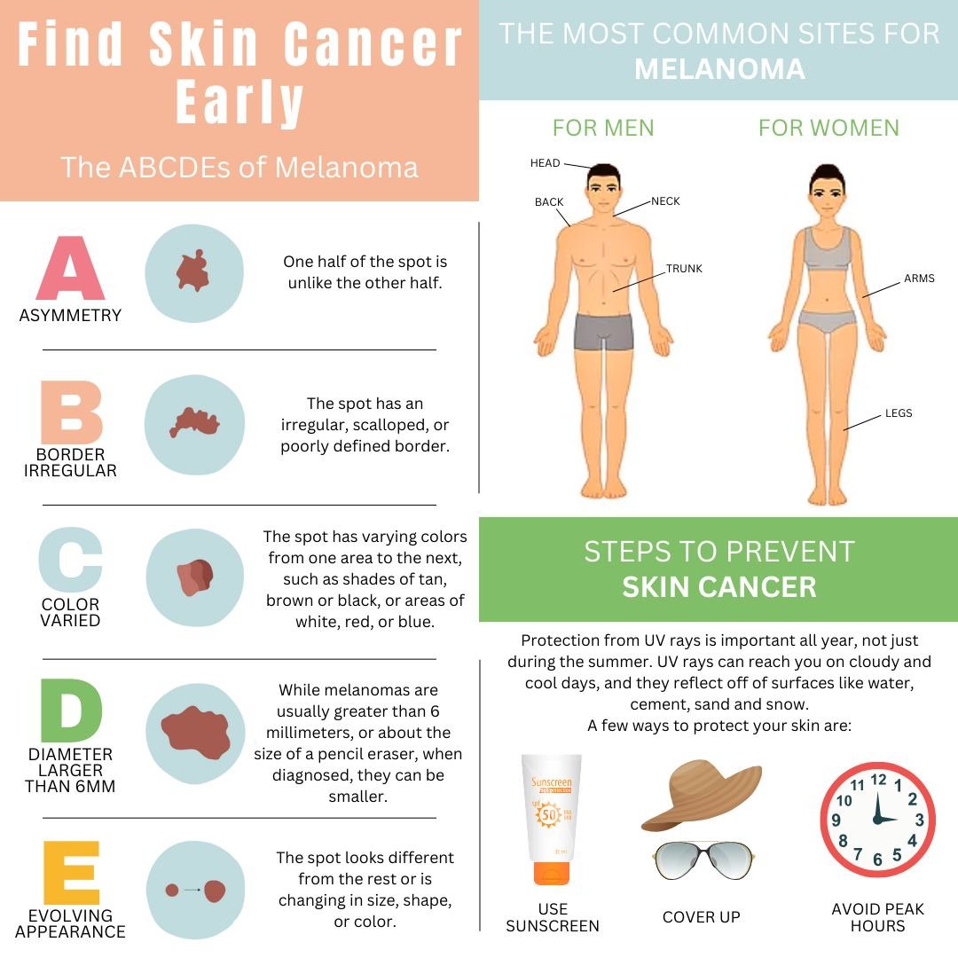 Early detection of Melanoma is as easy as A-B-C-D-E! Know what you're looking for in an irregular mole.

Asymmetry: Look for moles with irregular shapes

Border: Look for moles with irregular, notched or scalloped borders

Color: Look for moles/growt