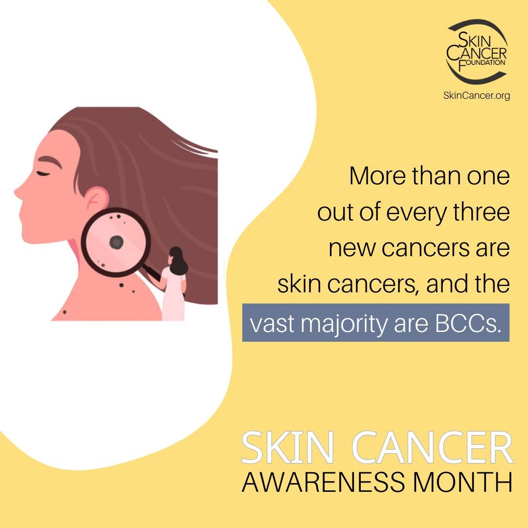 Did You Know?

Basal cell carcinoma (BCC) is the most common form of skin cancer. An estimated 3.6 million cases of BCC are diagnosed in the U.S. each year.

#GaDerm #SkinCancerAwarenessMonth #ThisIsSkinCancer #SharetheFacts #SkinCheckChallenge