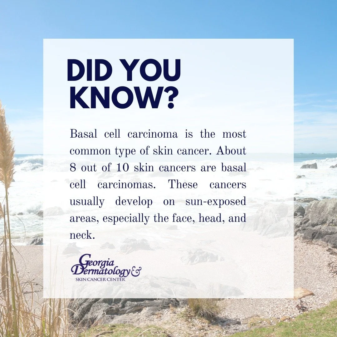 Did You Know?

Basal cell carcinoma is the most common type of skin cancer. About 8 out of 10 skin cancers are basal cell carcinomas. These cancers usually develop on sun-exposed areas, especially the face, head, and neck.

#GeorgiaDermatology #SkinC