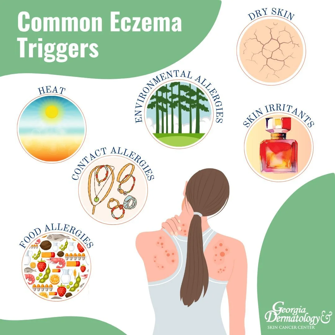 Our skin acts as a barrier, keeping out germs and other things that can harm us and sealing in water. When eczema develops, the skin's ability to act as that barrier diminishes, allowing irritants, potential allergens, bacteria and viruses to enter m