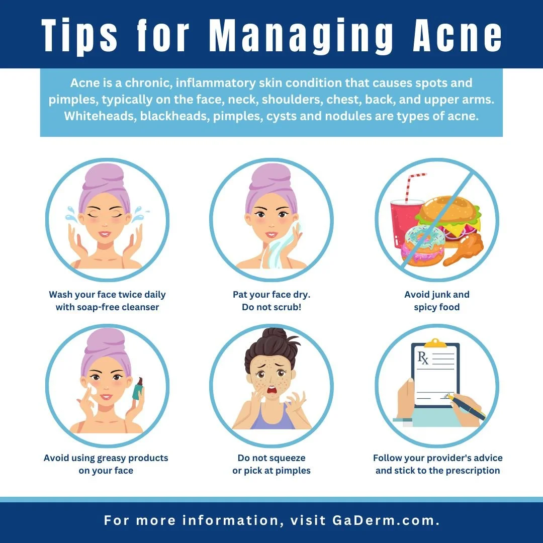 Control of acne is an ongoing process, and we offer a number of treatments all of which work to prevent new acne breakouts. Consistency and patience on the part of the patient are typically required as it can take time to find the exact regimen that 