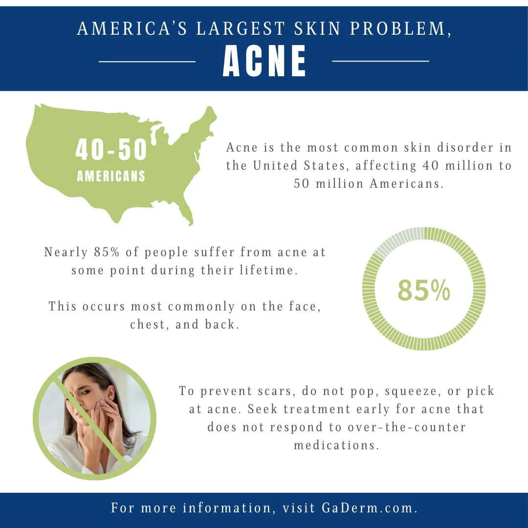 Acne is the most common skin disorder in the United States, affecting 40 million to 50 million Americans. Nearly 85% of people suffer from acne at some point during their lifetime.

This occurs most commonly on the face, chest and back. To prevent sc
