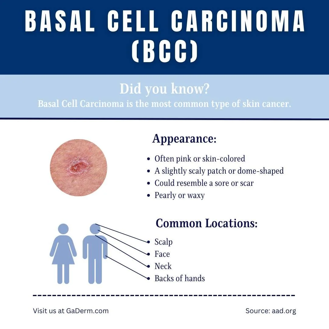 Basal cell carcinoma is the most common type of skin cancer. These pink, skin-colored spots often appear as a scaly or waxy patch and can be mistaken for a sore or scar. BCCs most commonly develop on the scalp, face, neck and backs of hands.

If you 