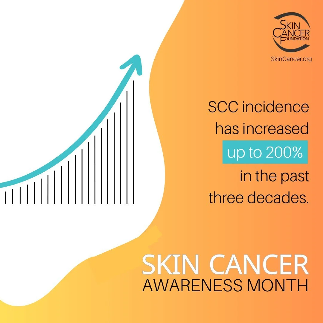 Did You Know?

Squamous cell carcinoma (SCC) is characterized by abnormal, accelerated growth of squamous cells. When caught early, most SCCs are curable.

#GaDerm #SkinCancerAwarenessMonth #ThisIsSkinCancer #SharetheFacts #SkinCheckChallenge