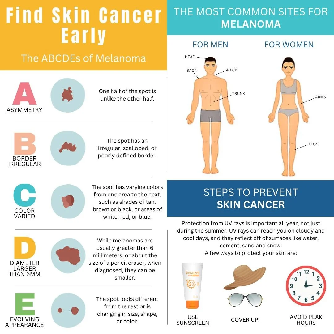 Early detection of Melanoma is as easy as A-B-C-D-E! Know what you're looking for in an irregular mole.

Asymmetry: Look for moles with irregular shapes

Border: Look for moles with irregular, notched or scalloped borders

Color: Look for moles/growt