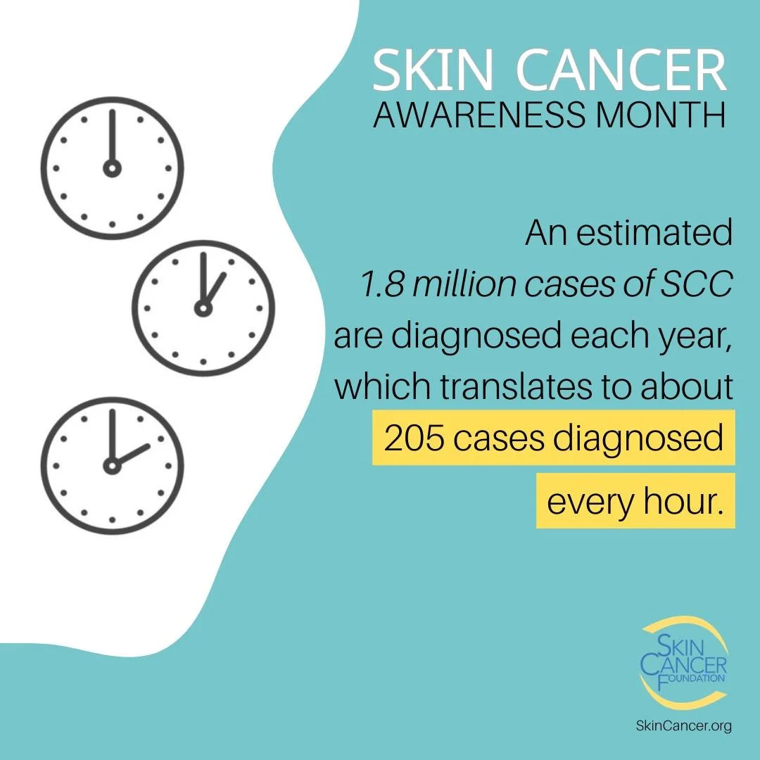 Did You Know?

Squamous cell carcinoma (SCC) is the second most common form of skin cancer. An estimated 1.8 million cases of SCC are diagnosed in the U.S. each year.

#GaDerm #SkinCancerAwarenessMonth #ThisIsSkinCancer #SharetheFacts #SkinCheckChall