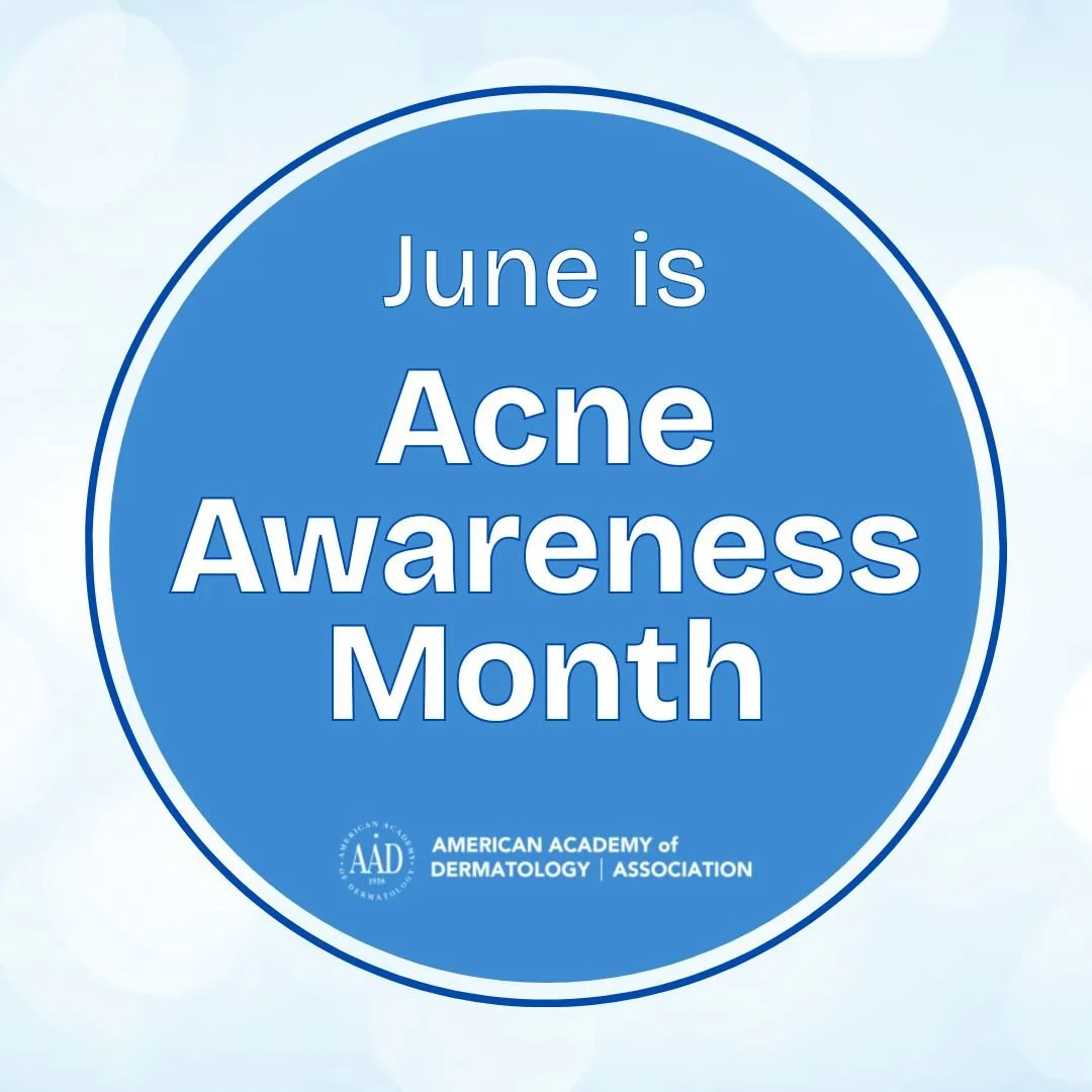 June is Acne Awareness Month!

Did you know? Over 85% of Americans report that they have experienced at least minor acne symptoms in their lifetime.

#AcneAwarenessMonth #GeorgiaDermatology #SkinCancerSpecialists #clearskin