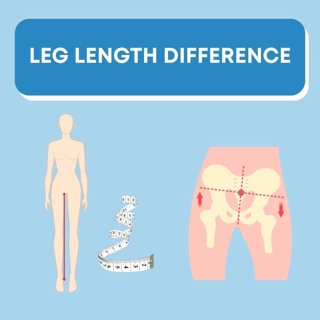 Leg Length Discrepancy – Causes, Symptoms & Podiatry Treatment