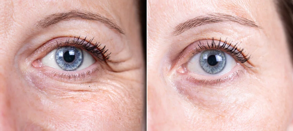 INNO EYE TREATMENT.jpeg