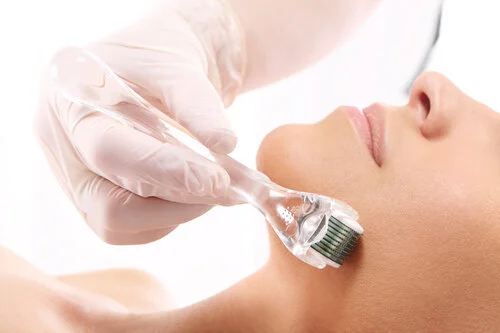 Microneedling+.jpeg