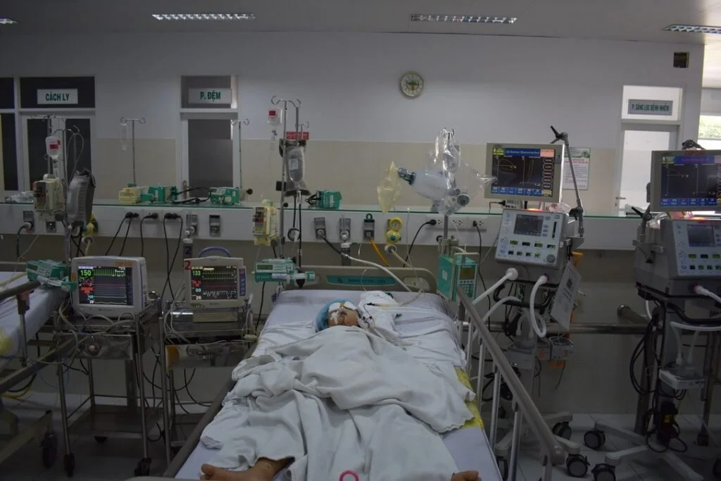 A young Vietnamese girl admitted to ICU for snake bite