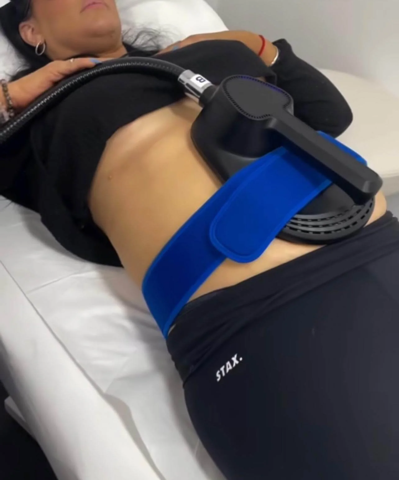 EMS muscle sculpting targeting the abdomen