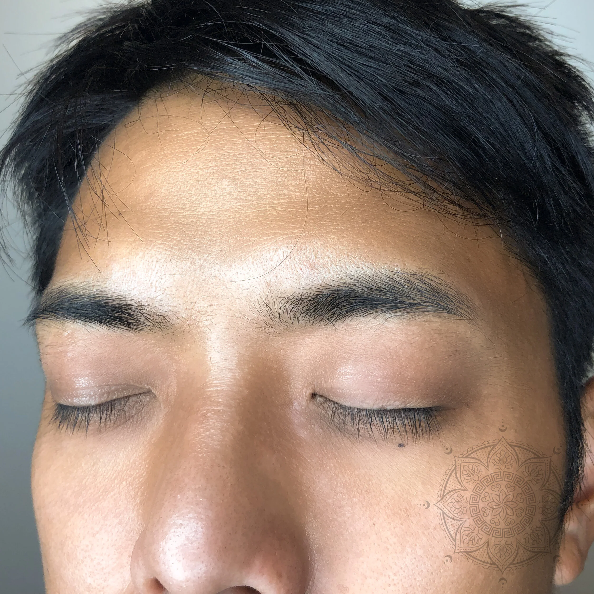 BEFORE