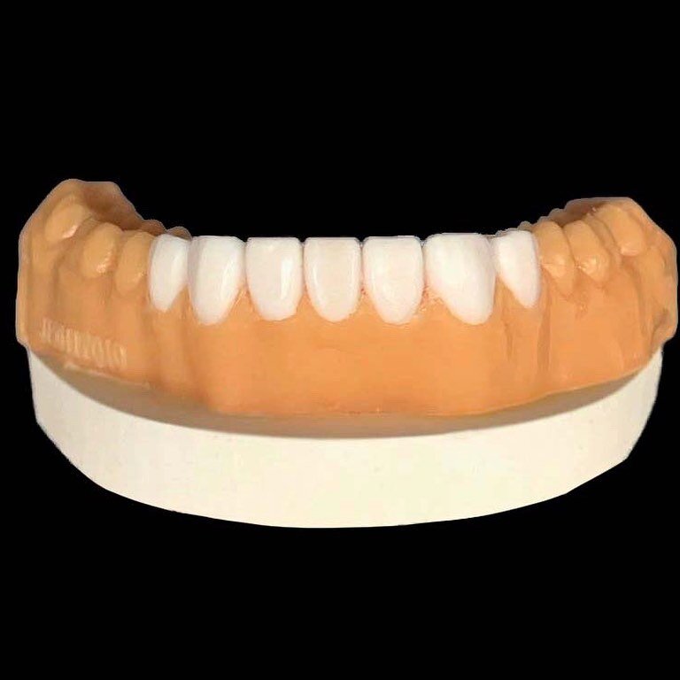 Diagnostic Wax-Up.
.
.
.
.
.
#diagnosticwaxup #waxup #wax #waxing #teethwhitening #teeth #smile😊 #smilemore #dentist #dentallaboratory #dentallab #dentalassistant #diagnosis #whiteteeth