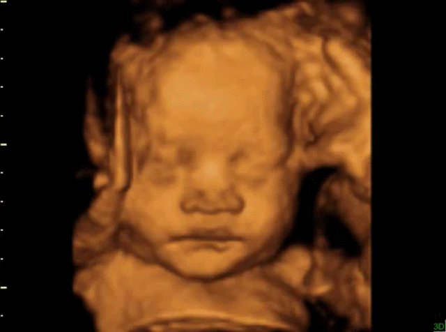 3D / 4D scanning at ScanSanctuary pregnancy prenatal scanning clinic. — ScanSanctuary: / Baby Scanning on the Isle of Man